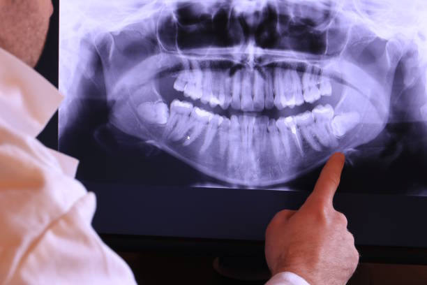 Best Emergency Root Canal Therapy in Crofton, MD