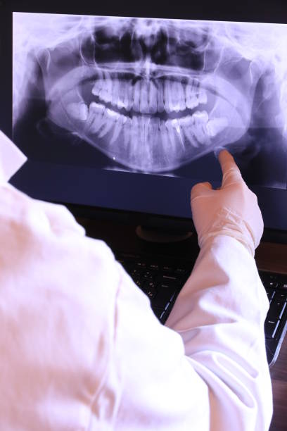 Best Emergency Wisdom Tooth Extraction in Crofton, MD